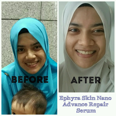 Ephyra Skin Nano Advance Repair Serum