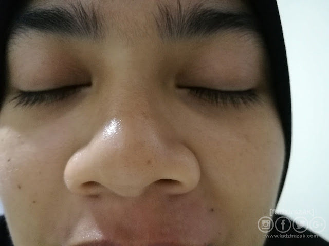 Before Neutrogena Deep Clean Blackhead Eliminating Daily Scrub
