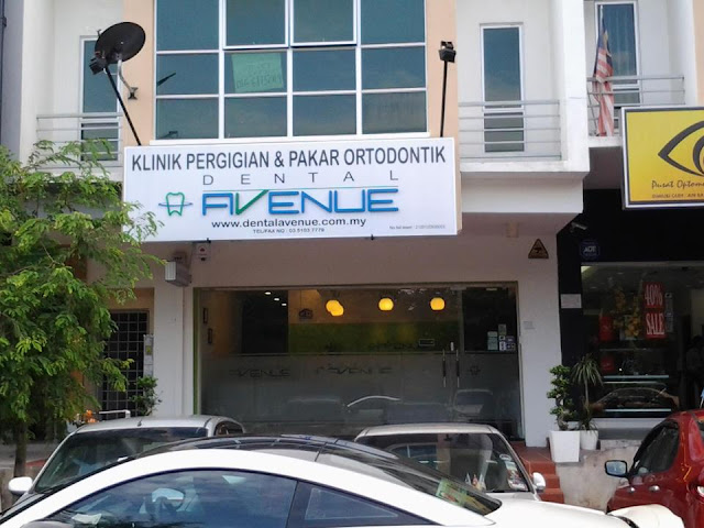 Diskaun Rawatan Invisalign RM2000