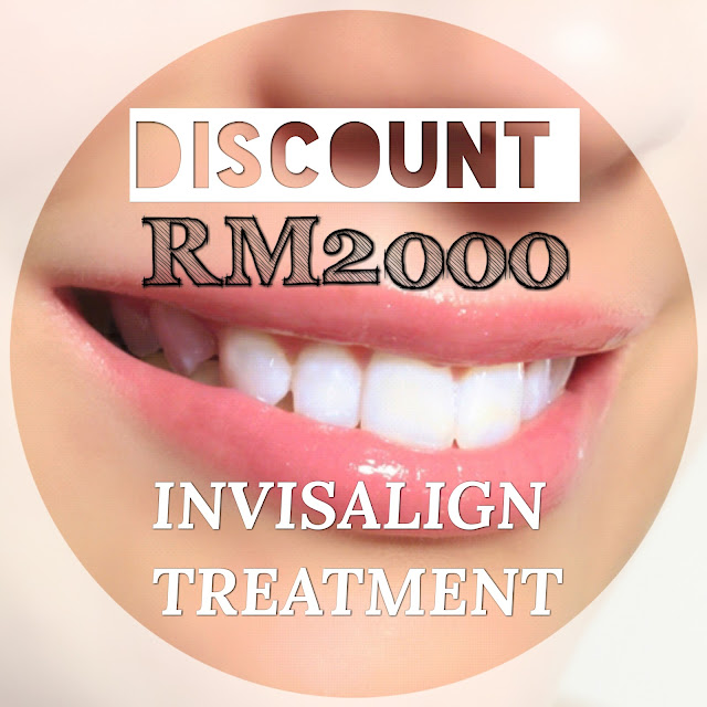 Discount RM2000 Invisalign Treatment