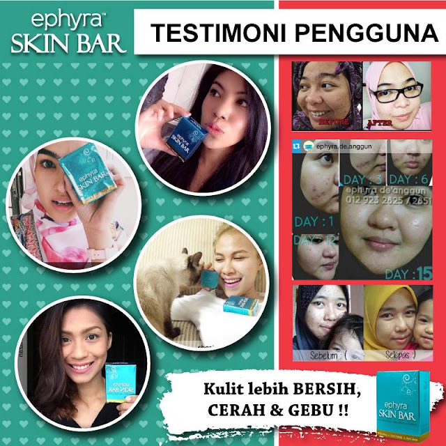 Testimoni Ephyra Skin Bar