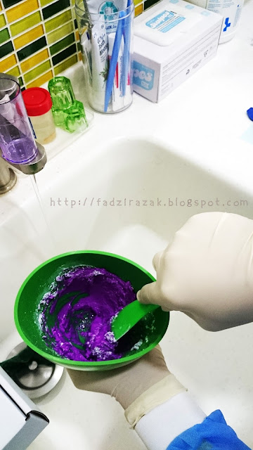 Mould invisalign
