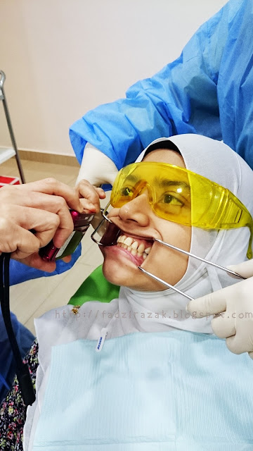 Invisalign treatment